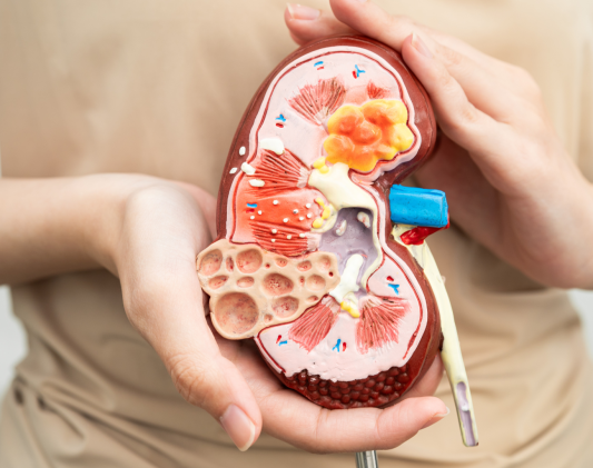 Hands holding a cross-section model of a human kidney showing its internal structure, including a cyst, a tumour and kidney stones