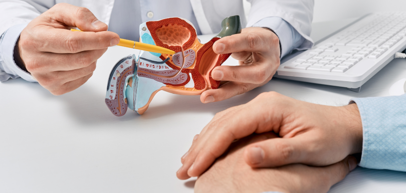 Urologist using a prostate anatomy model to explain a prostate biopsy to a male patient during a consultation