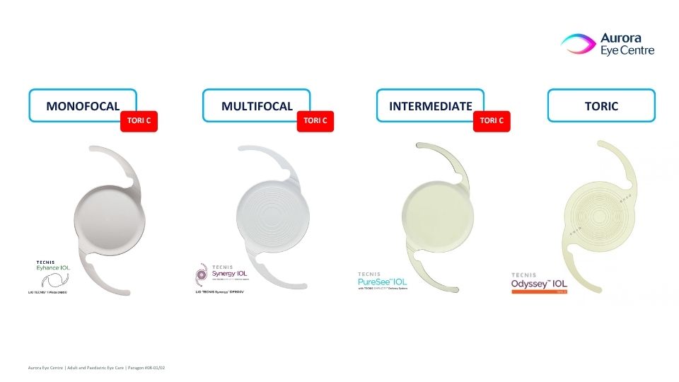 Comparison of four types of intraocular lenses (IOLs) used in cataract surgery: monofocal, multifocal, intermediate and toric